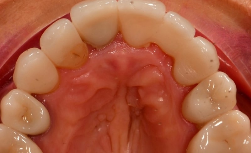 After -Bromsgrove Dental