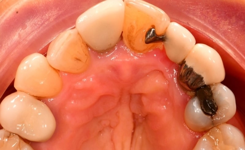 Before - Bromsgrove Dental