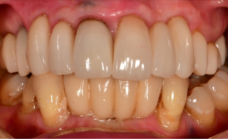 After -Bromsgrove Dental