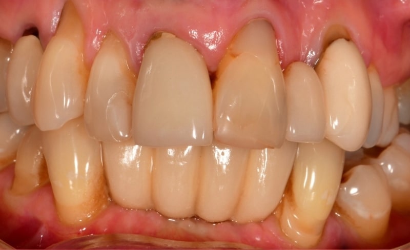 Before - Bromsgrove Dental