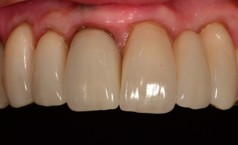 After -Bromsgrove Dental