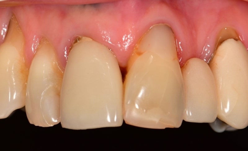 Before - Bromsgrove Dental