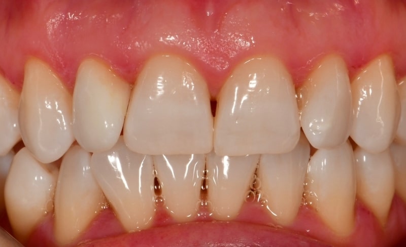 After -Bromsgrove Dental