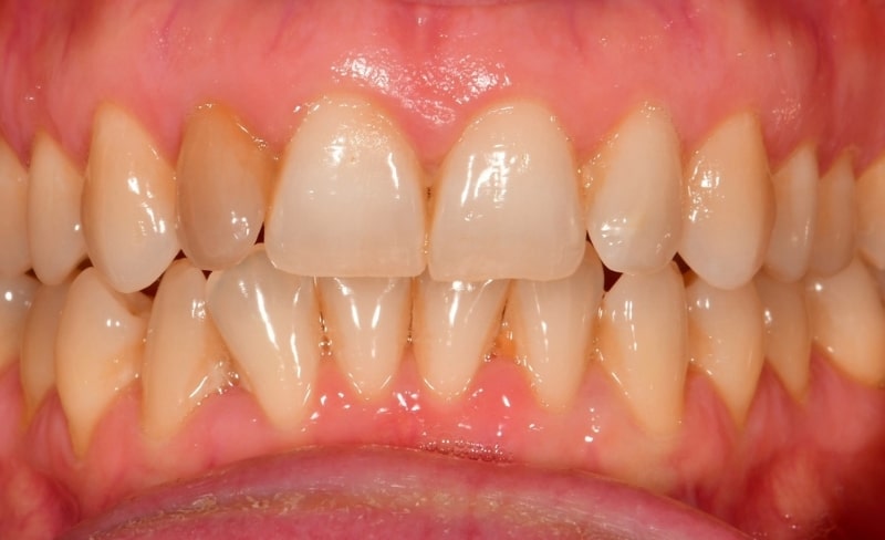 Before - Bromsgrove Dental