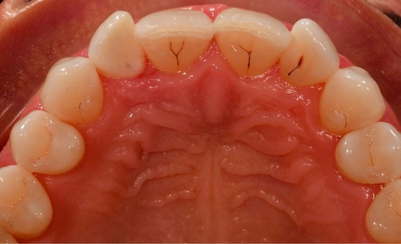 Before - Bromsgrove Dental