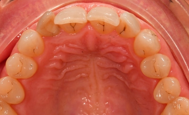 After -Bromsgrove Dental