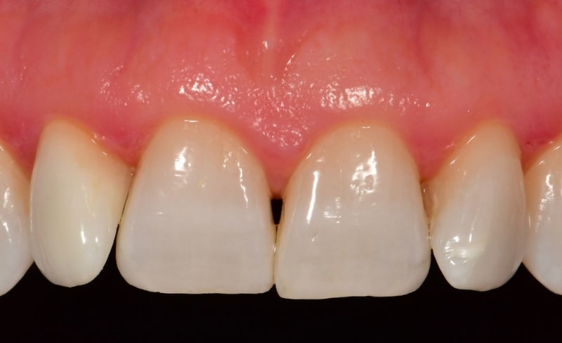 After -Bromsgrove Dental