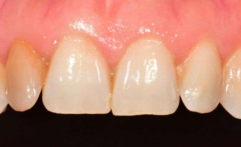 Before - Bromsgrove Dental
