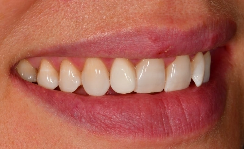After -Bromsgrove Dental