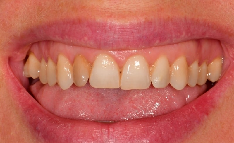 Before - Bromsgrove Dental