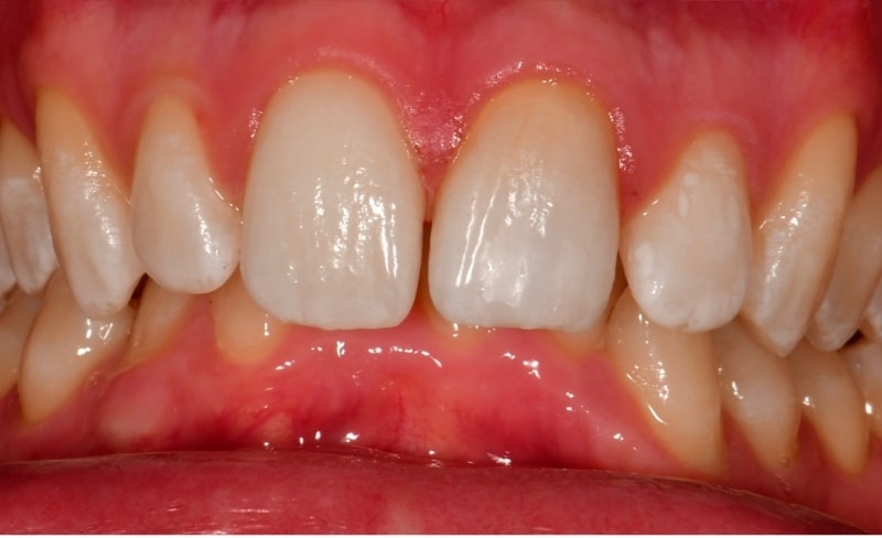 After -Bromsgrove Dental