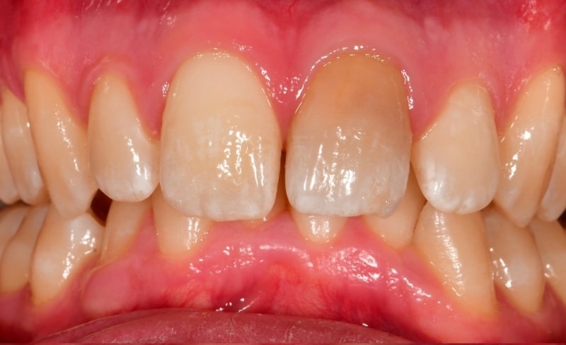 Before - Bromsgrove Dental