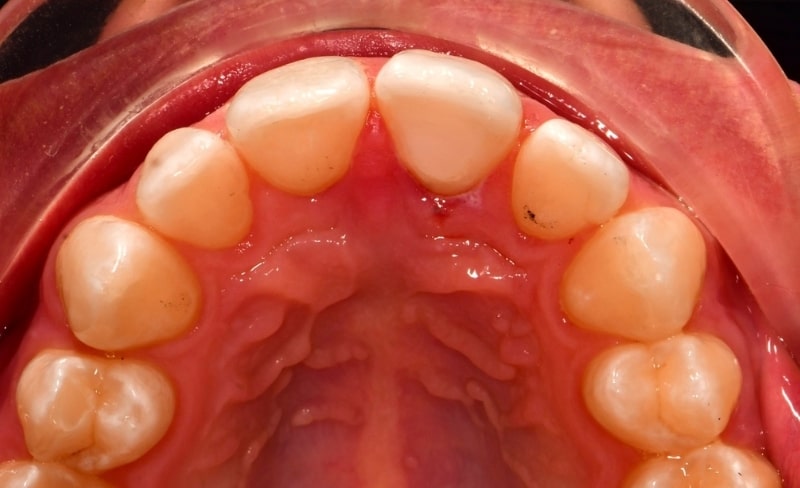 After -Bromsgrove Dental