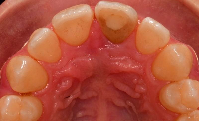 Before - Bromsgrove Dental