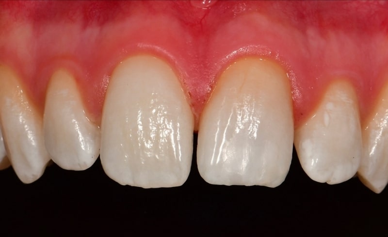 After -Bromsgrove Dental