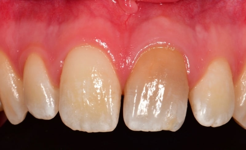 Before - Bromsgrove Dental