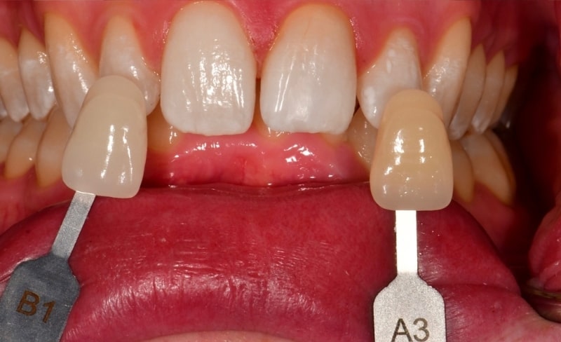 After -Bromsgrove Dental