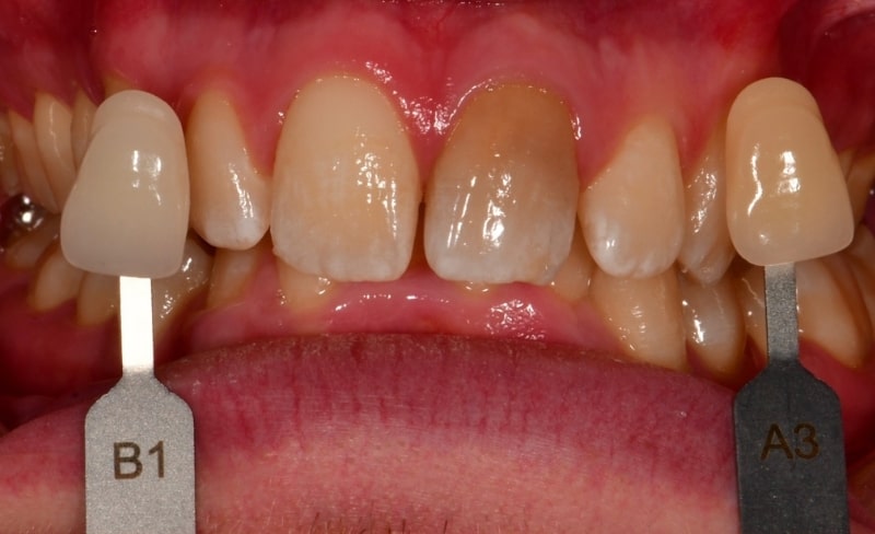 Before - Bromsgrove Dental