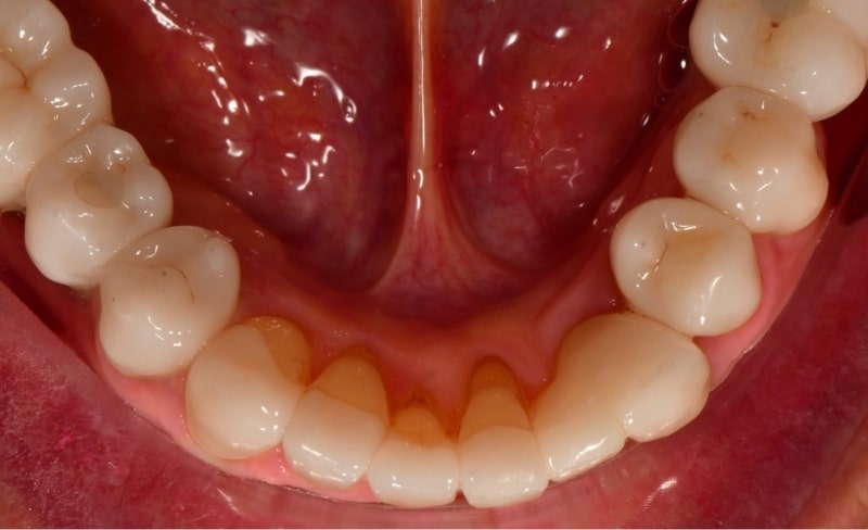 After -Bromsgrove Dental