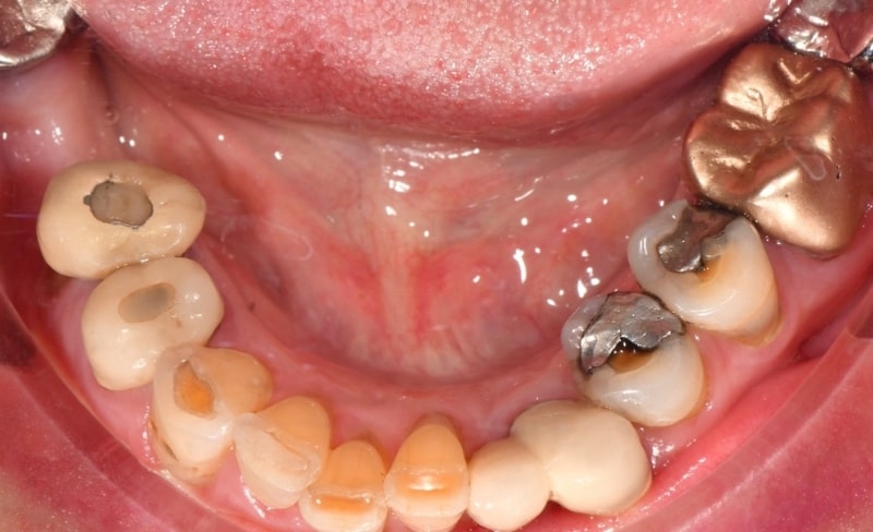 Before - Bromsgrove Dental