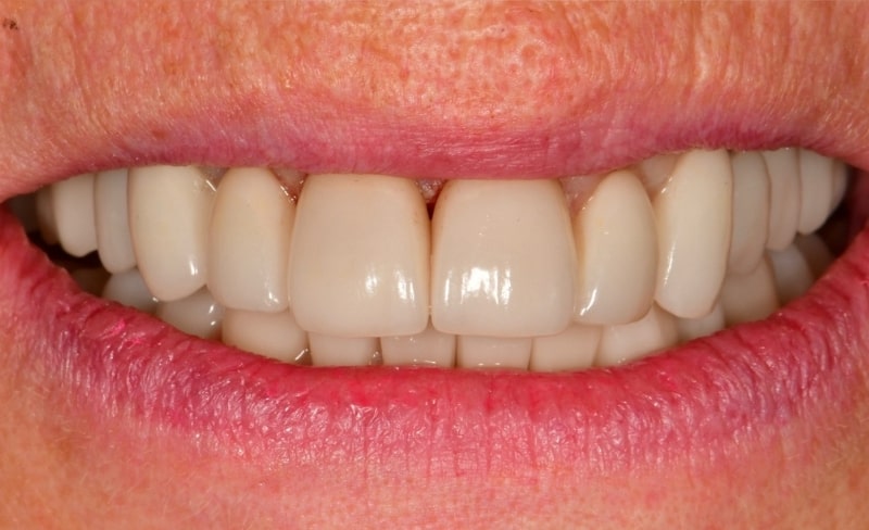 After -Bromsgrove Dental