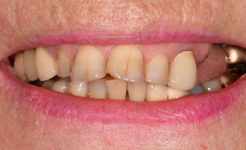 Before - Bromsgrove Dental
