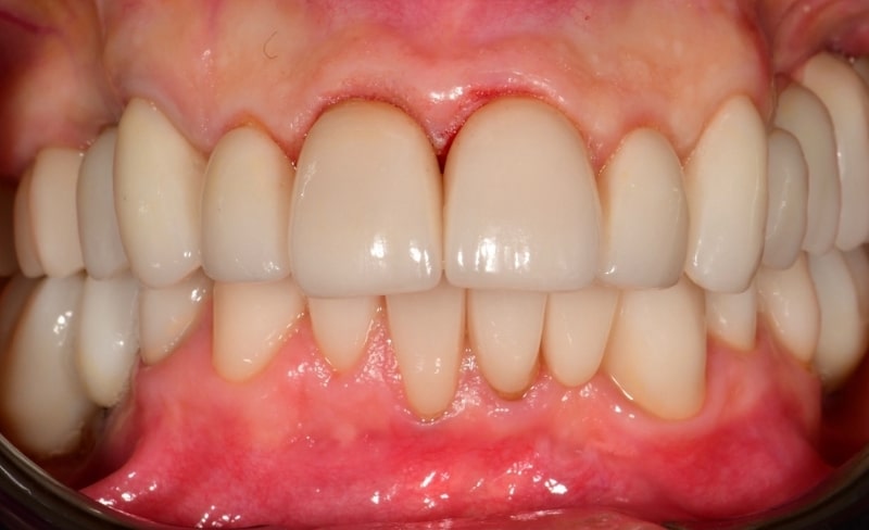 After -Bromsgrove Dental