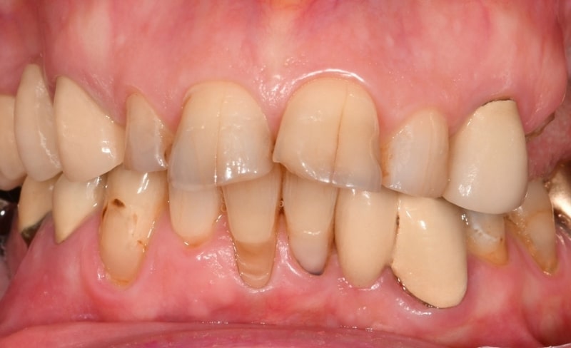 Before - Bromsgrove Dental