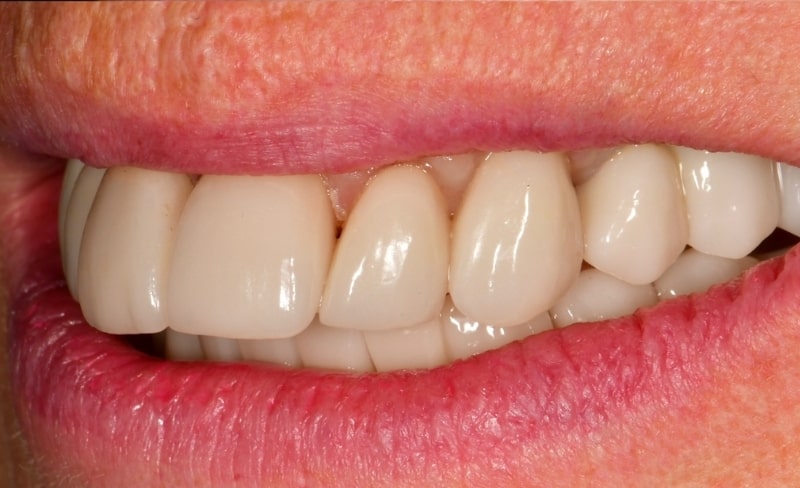 After -Bromsgrove Dental