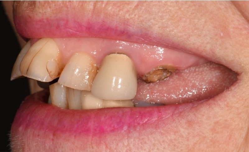 Before - Bromsgrove Dental