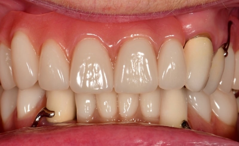 After -Bromsgrove Dental