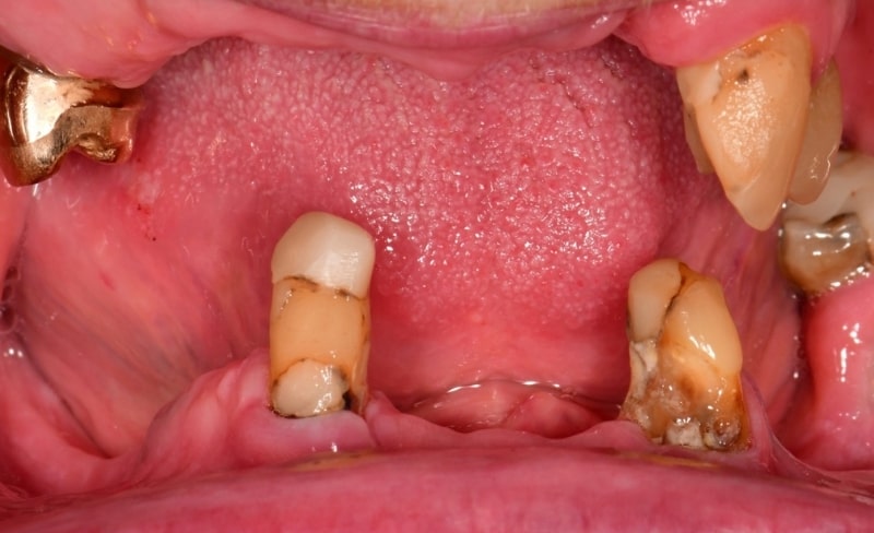 Before - Bromsgrove Dental
