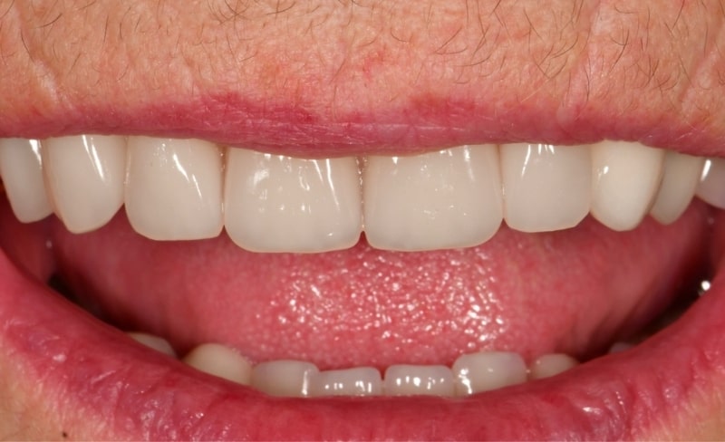 After -Bromsgrove Dental