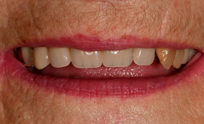 Before - Bromsgrove Dental