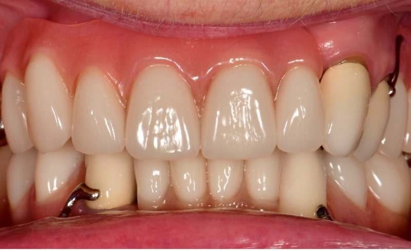 After -Bromsgrove Dental