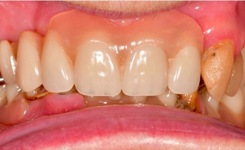 Before - Bromsgrove Dental