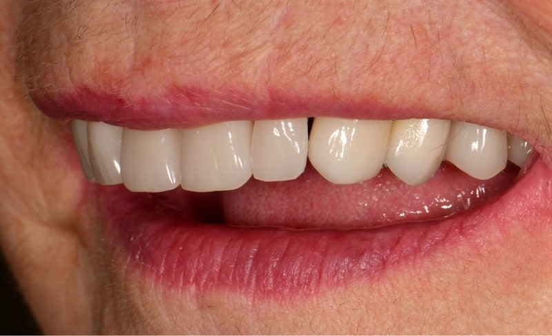 After -Bromsgrove Dental