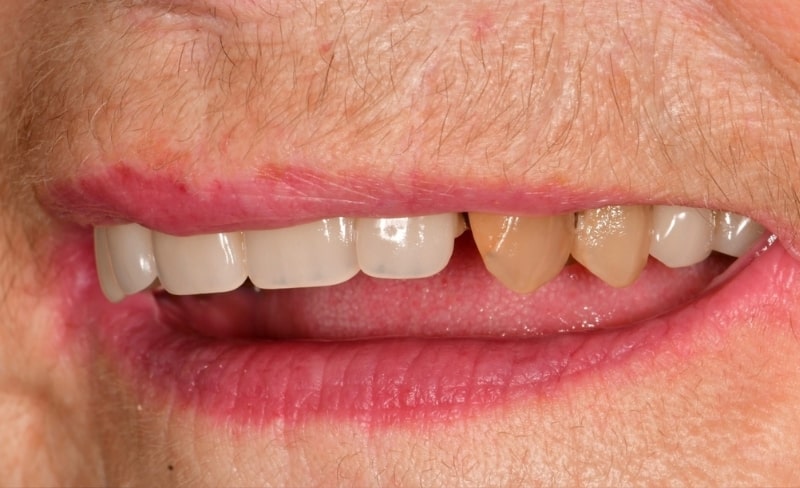 Before - Bromsgrove Dental